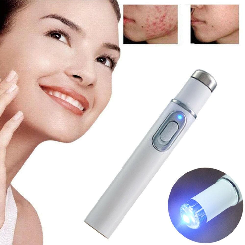 Blue Light Therapy Acne Pen - Beauty And Personal Care - DINIBLO 