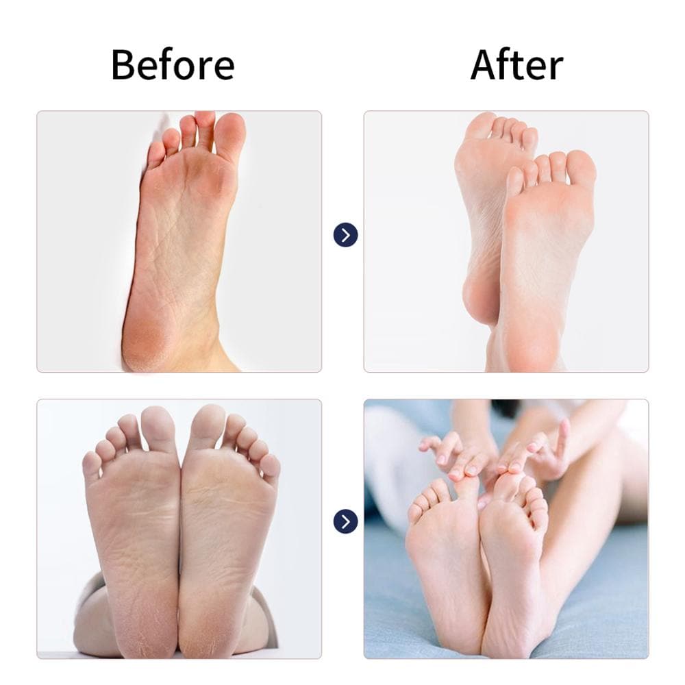 Electric Feet Callus Remover - Beauty And Personal Care - DINIBLO 