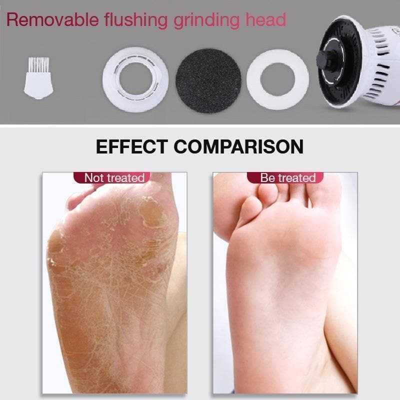 Electric Vacuum Adsorption Foot Grinder - Beauty And Personal Care - DINIBLO 