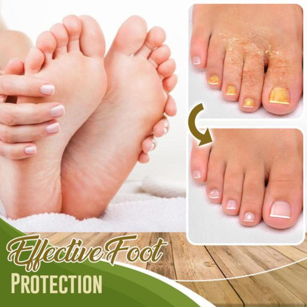 Fungal Treatment Foot Spray - Beauty And Personal Care - DINIBLO 