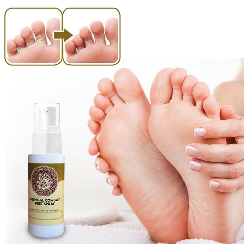 Fungal Treatment Foot Spray - Beauty And Personal Care - DINIBLO 