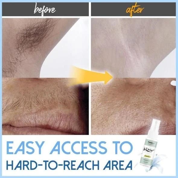 Wonder Hair Removal Spray - Replace Your Shave Cream For Good! - Beauty And Personal Care - DINIBLO 