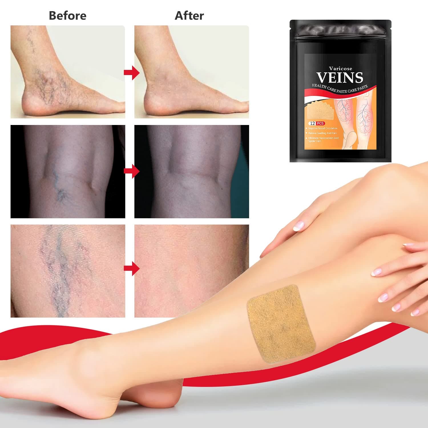 Varicose Veins Treatment Patch - Skin Care Masks & Peels - DINIBLO 